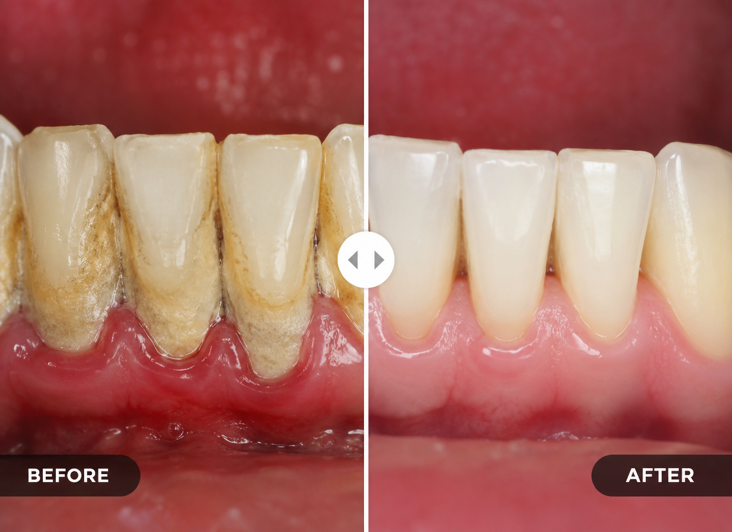 Before treatment