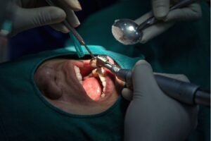 Oral Cavity Biopsies